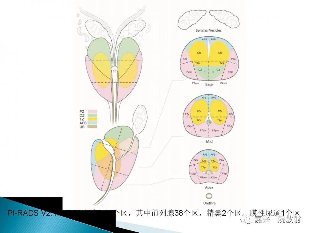 影像PPT - 【PPT】前列腺解剖分区-17