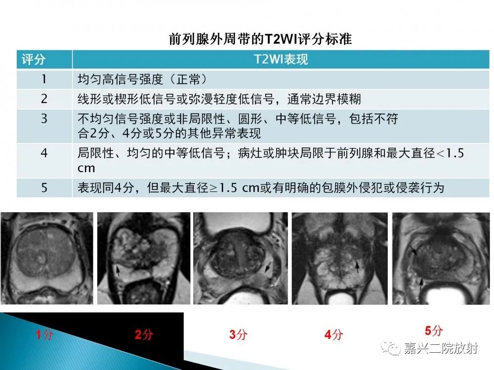 影像PPT - 【PPT】前列腺解剖分区-18