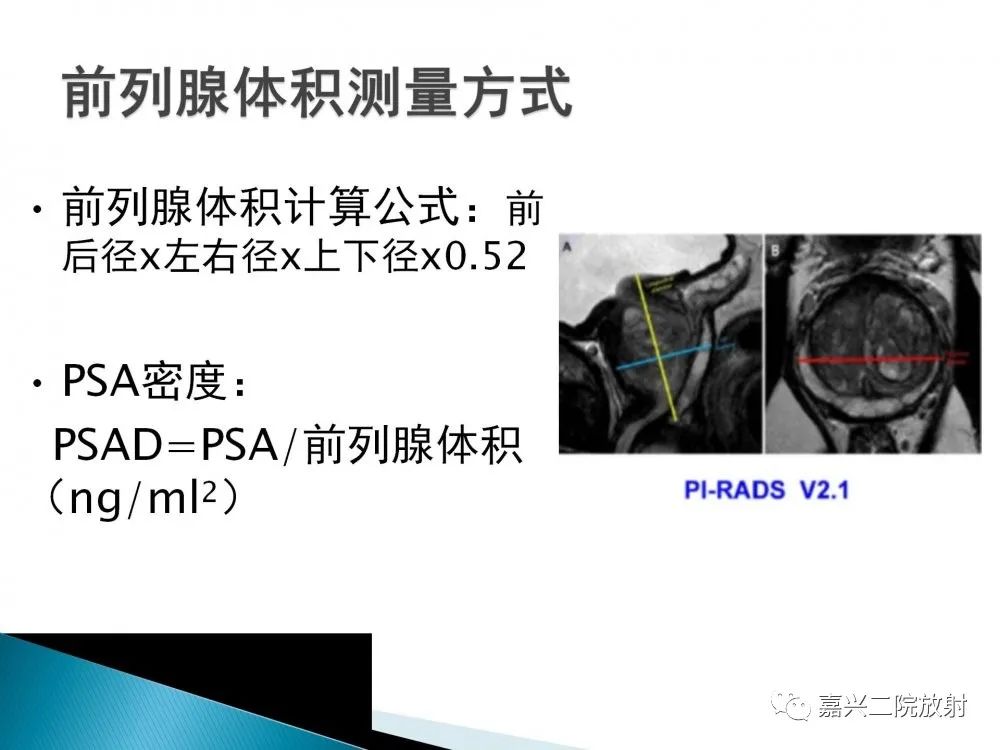 影像PPT - 【PPT】前列腺解剖分区-16