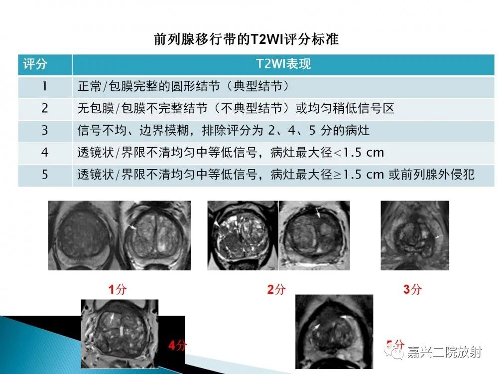 影像PPT - 【PPT】前列腺解剖分区-20