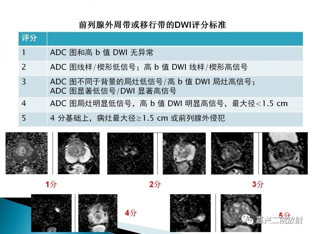 影像PPT - 【PPT】前列腺解剖分区-19