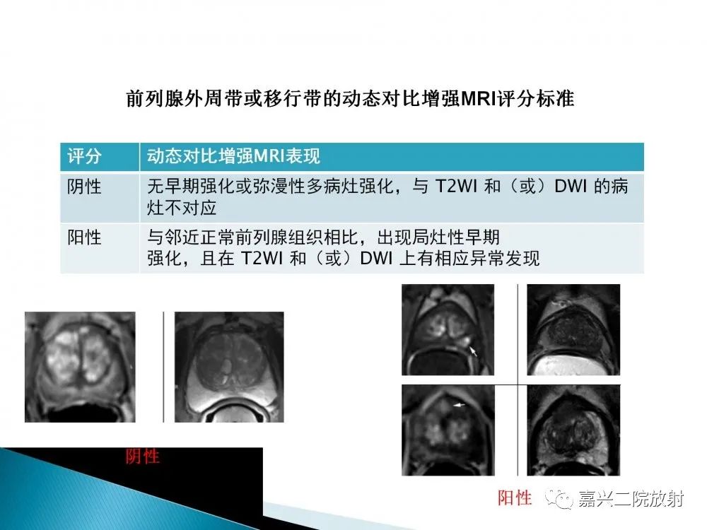 影像PPT - 【PPT】前列腺解剖分区-22