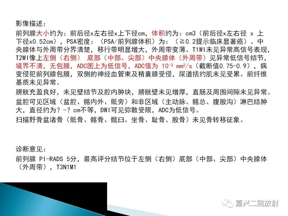 影像PPT - 【PPT】前列腺解剖分区-24