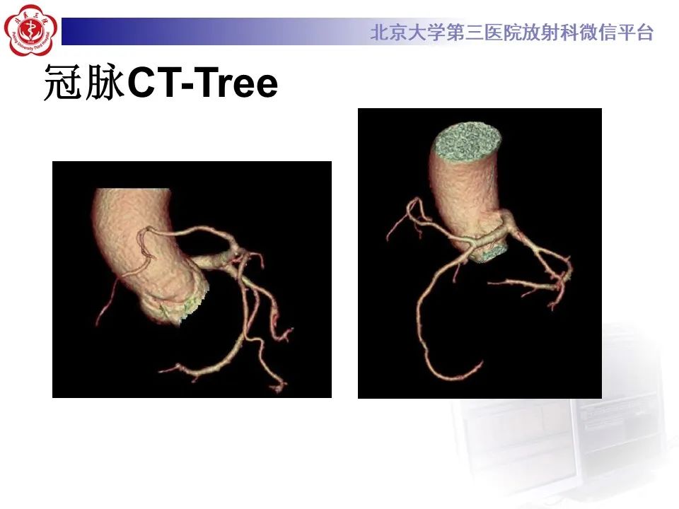 影像PPT - 【PPT】冠状动脉解剖异常-4