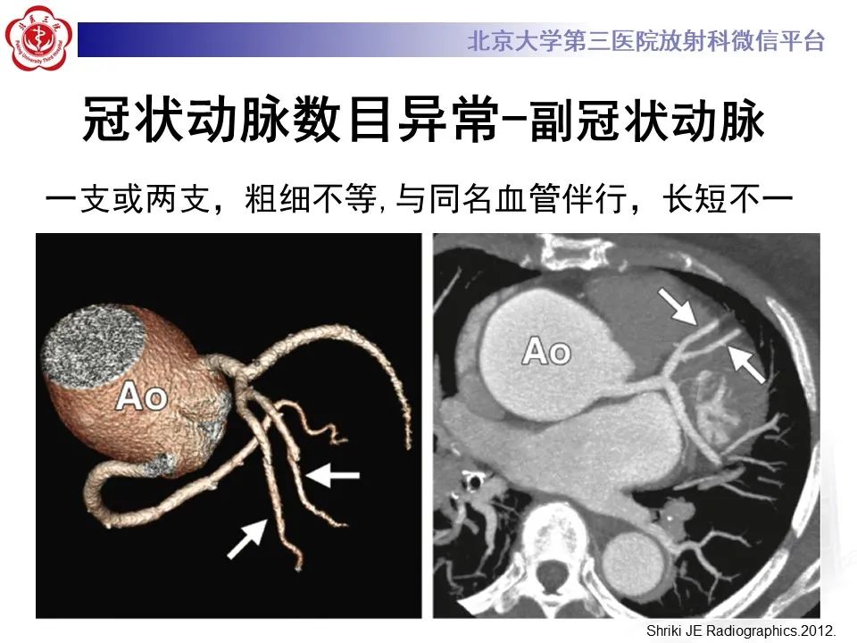影像PPT - 【PPT】冠状动脉解剖异常-18