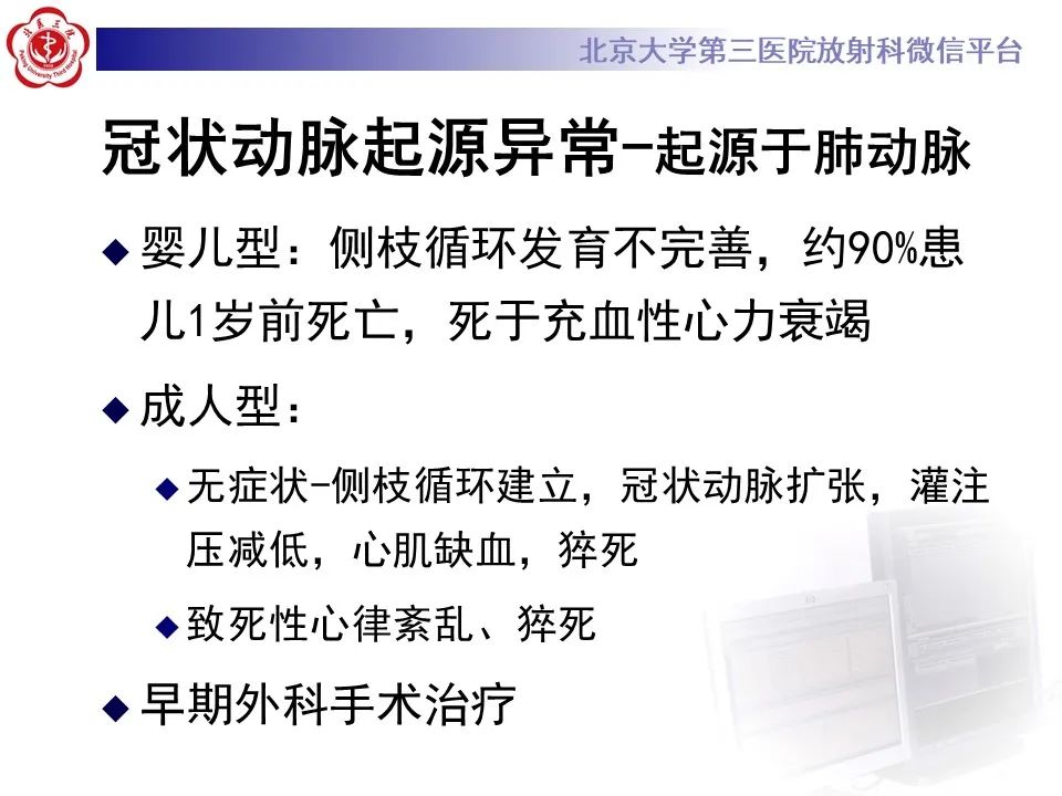 影像PPT - 【PPT】冠状动脉解剖异常-22