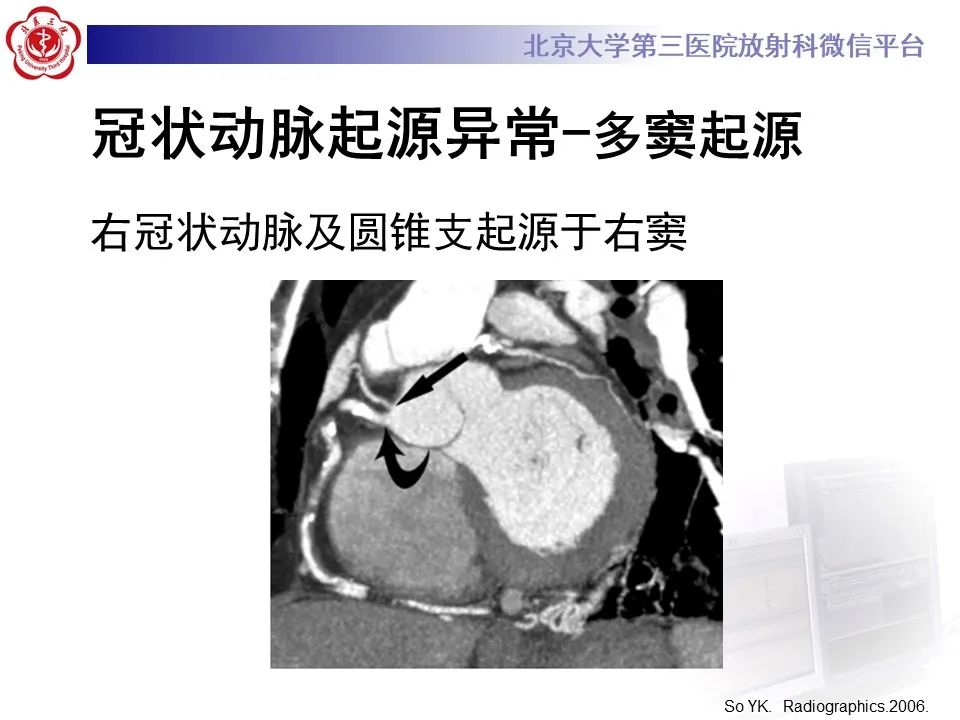 影像PPT - 【PPT】冠状动脉解剖异常-35