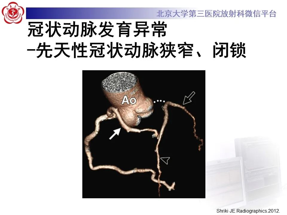 影像PPT - 【PPT】冠状动脉解剖异常-58