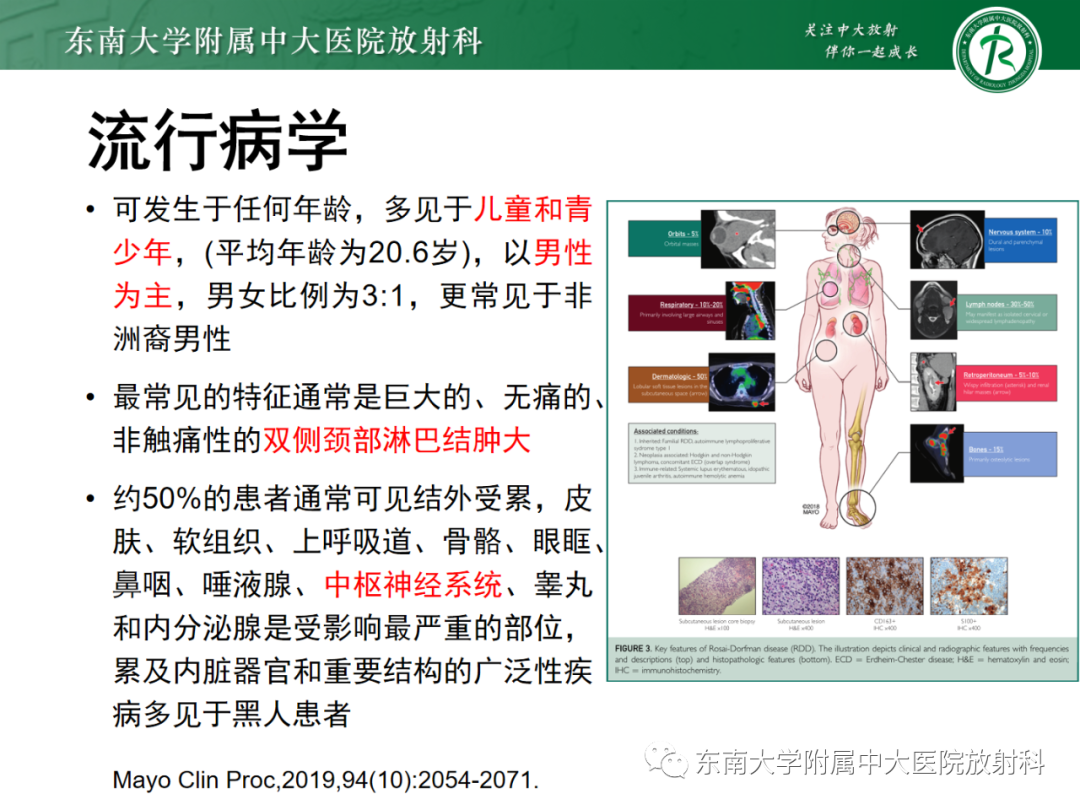 影像PPT - 【PPT】中枢神经系统罗道病-7 影像PPT - 【PPT】中枢神经系统罗道病-7