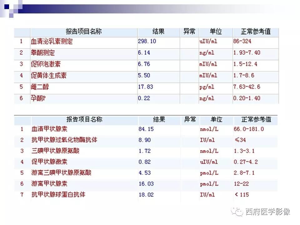 影像PPT - 【PPT】垂体囊性病变回顾性讨论-7