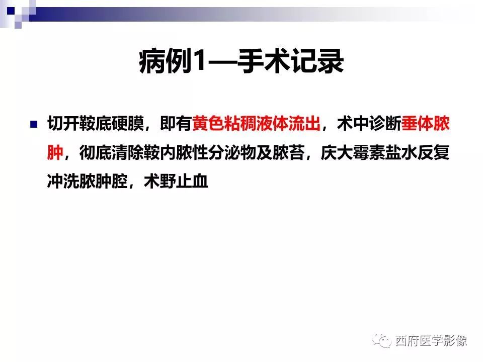 影像PPT - 【PPT】垂体囊性病变回顾性讨论-18