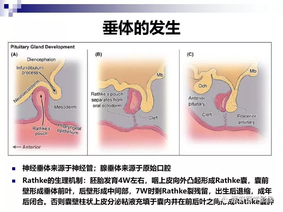 影像PPT - 【PPT】垂体囊性病变回顾性讨论-23