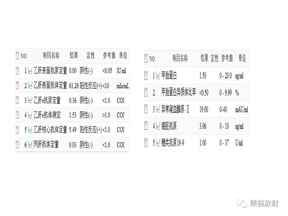 影像PPT - 【PPT】胃肠道间质瘤GIST VS 胃平滑肌瘤-3