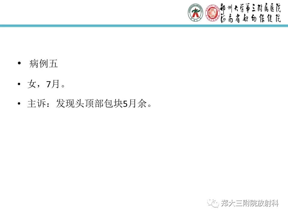 影像PPT - 【PPT】皮样囊肿与表皮样囊肿的鉴别-27