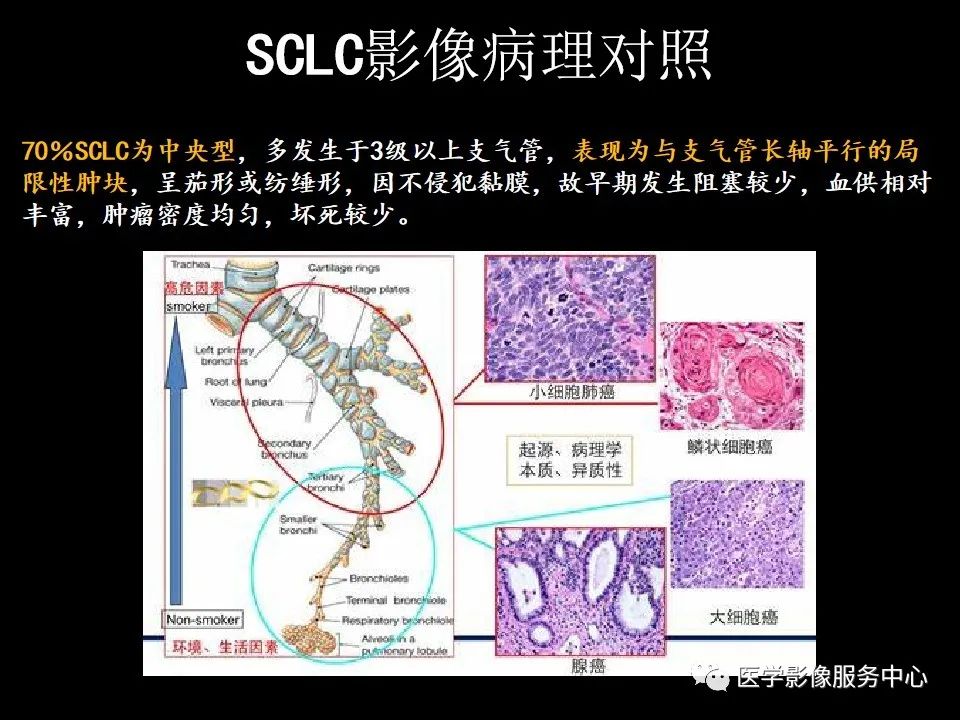 影像PPT - 【病例】中央型小细胞肺癌的CT与病理分析-12