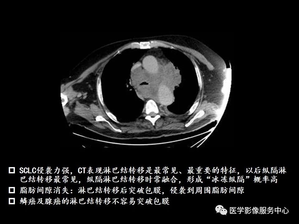 影像PPT - 【病例】中央型小细胞肺癌的CT与病理分析-34