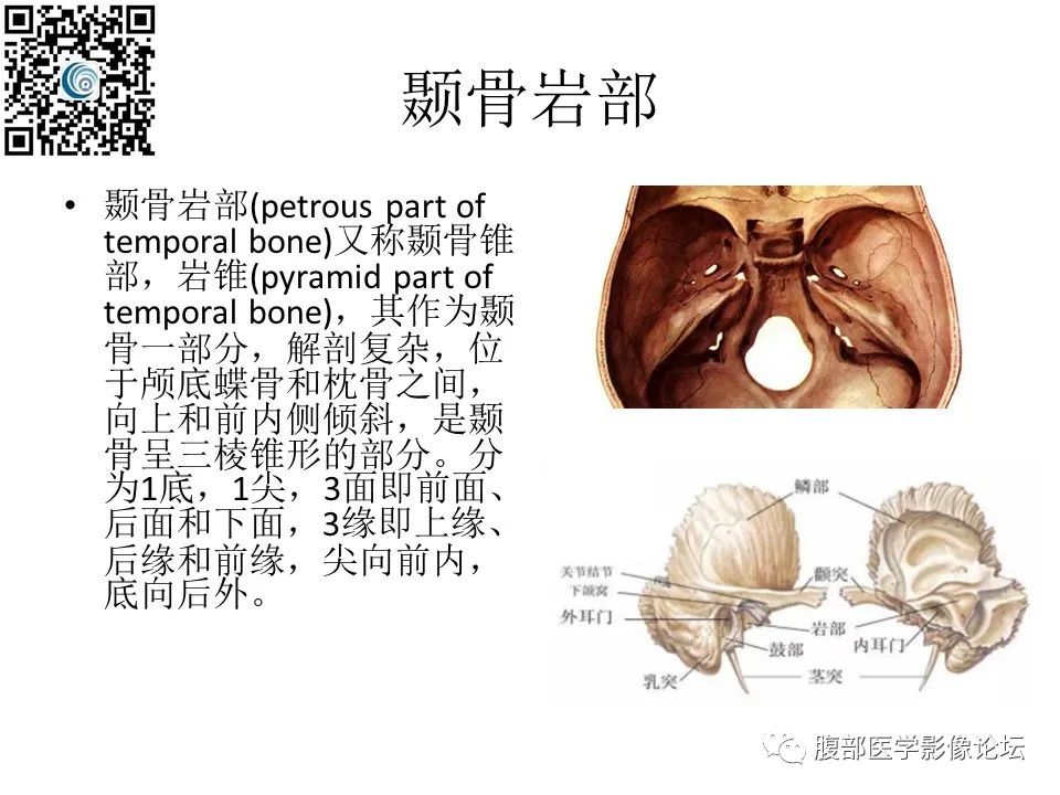 影像PPT - 【PPT】颅骨颅底系列之岩洞深处住神仙-2
