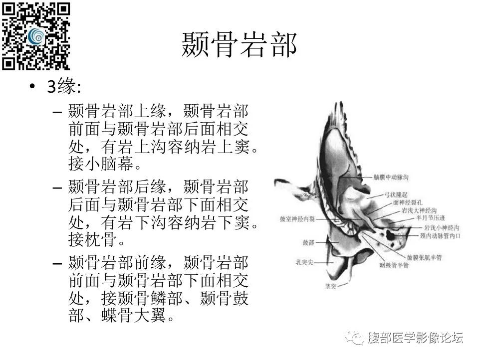 影像PPT - 【PPT】颅骨颅底系列之岩洞深处住神仙-4
