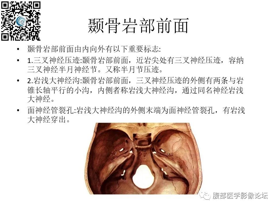 影像PPT - 【PPT】颅骨颅底系列之岩洞深处住神仙-5