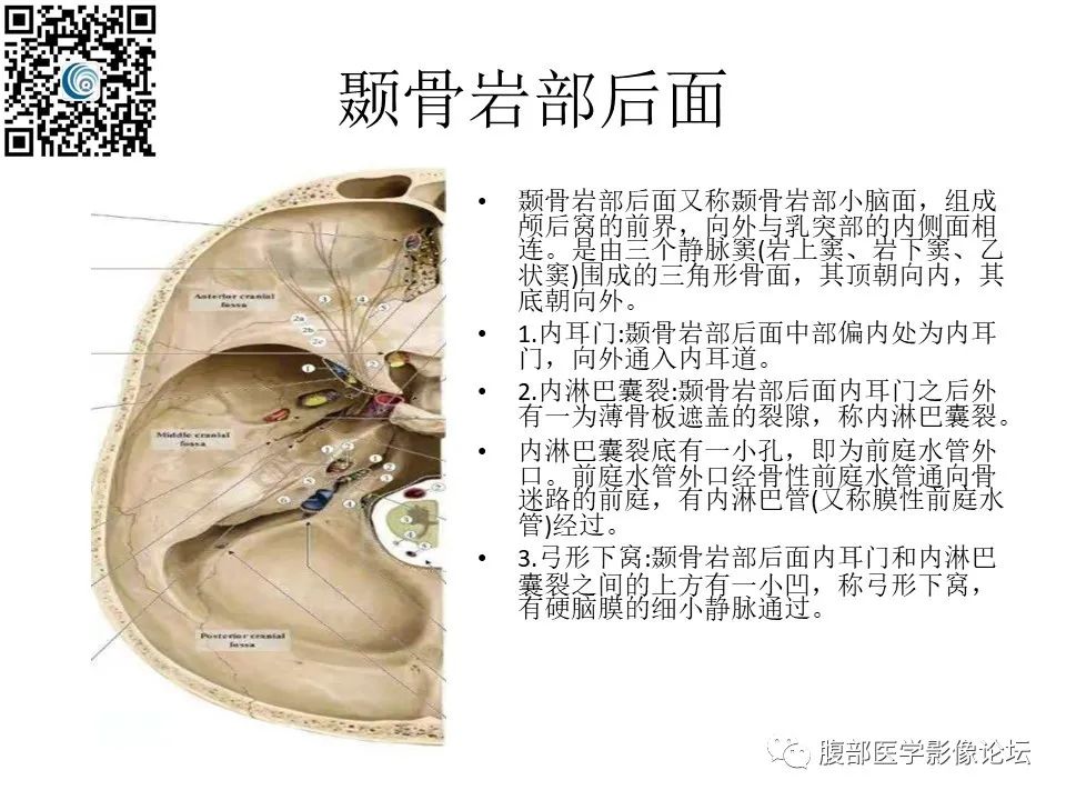 影像PPT - 【PPT】颅骨颅底系列之岩洞深处住神仙-7