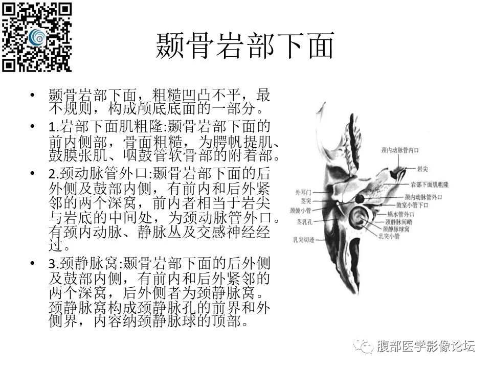影像PPT - 【PPT】颅骨颅底系列之岩洞深处住神仙-8