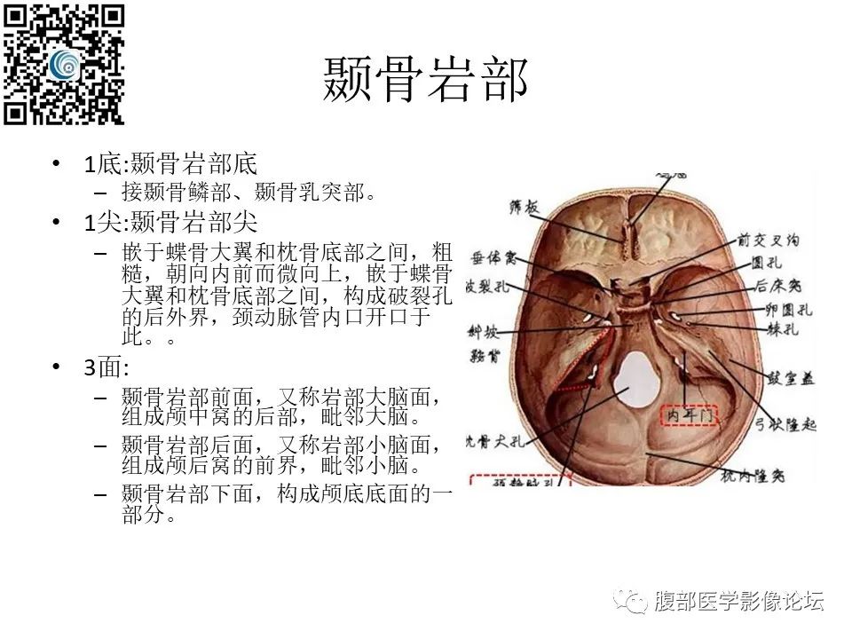 影像PPT - 【PPT】颅骨颅底系列之岩洞深处住神仙-3