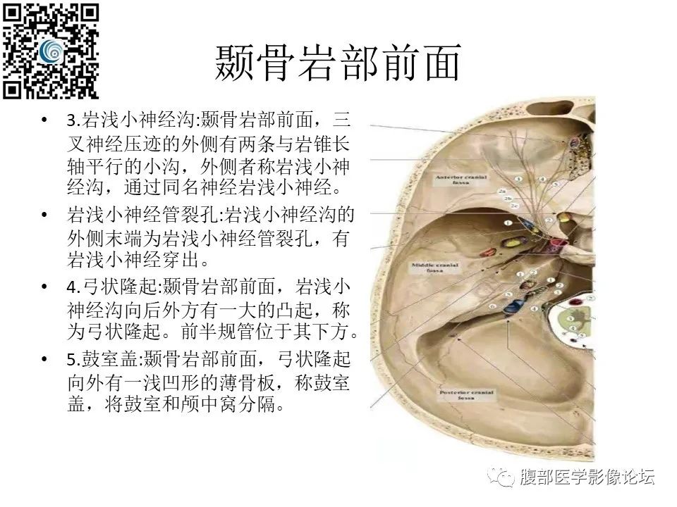影像PPT - 【PPT】颅骨颅底系列之岩洞深处住神仙-6