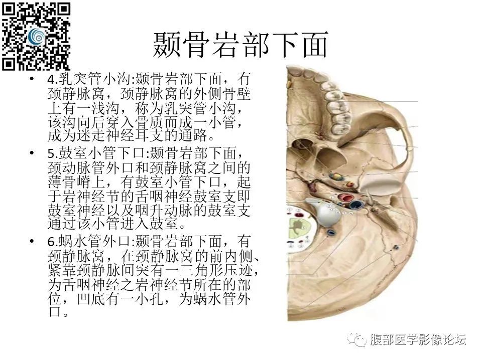 影像PPT - 【PPT】颅骨颅底系列之岩洞深处住神仙-9
