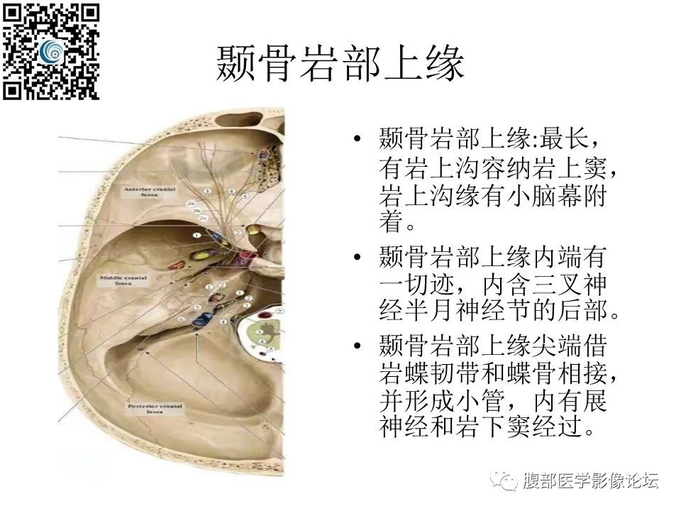 影像PPT - 【PPT】颅骨颅底系列之岩洞深处住神仙-10