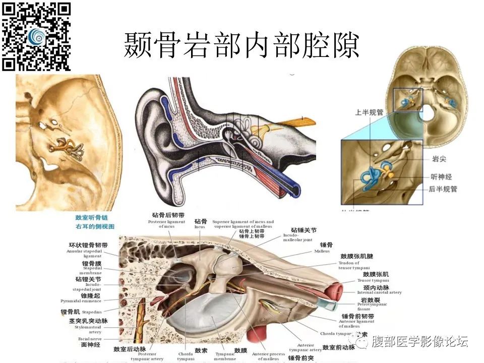 影像PPT - 【PPT】颅骨颅底系列之岩洞深处住神仙-13