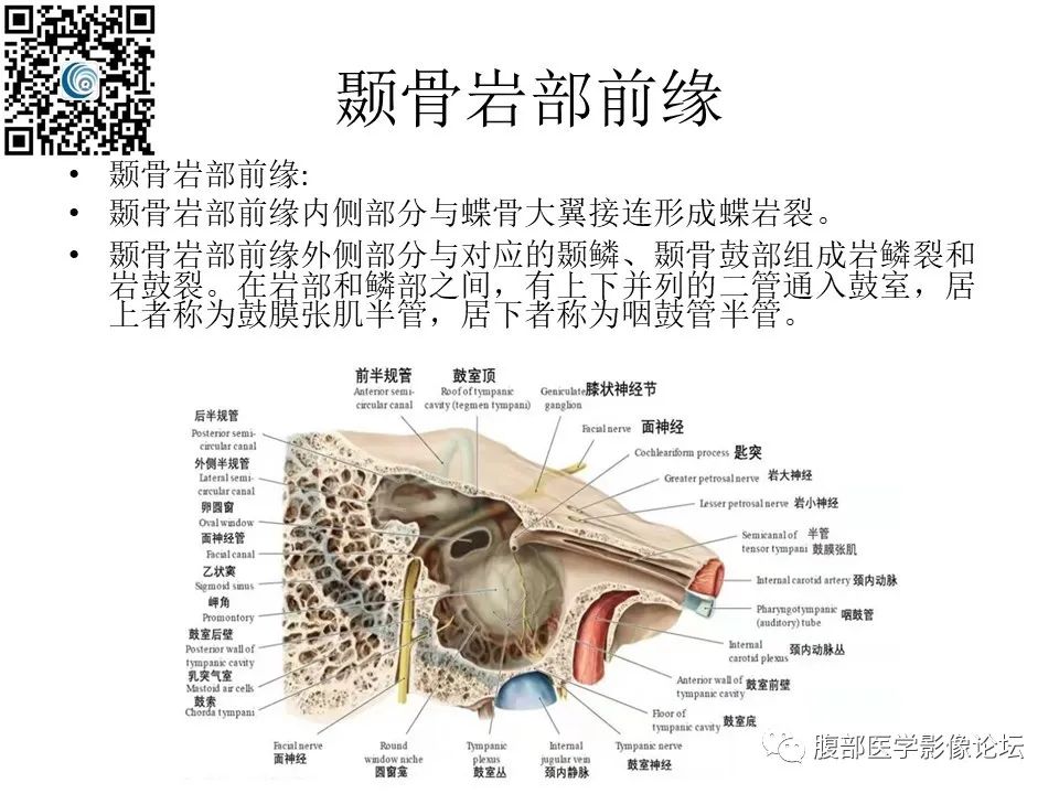 影像PPT - 【PPT】颅骨颅底系列之岩洞深处住神仙-12