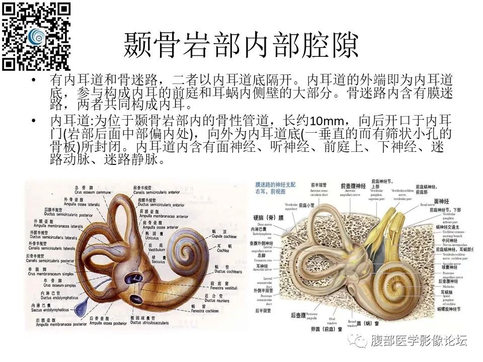 影像PPT - 【PPT】颅骨颅底系列之岩洞深处住神仙-14