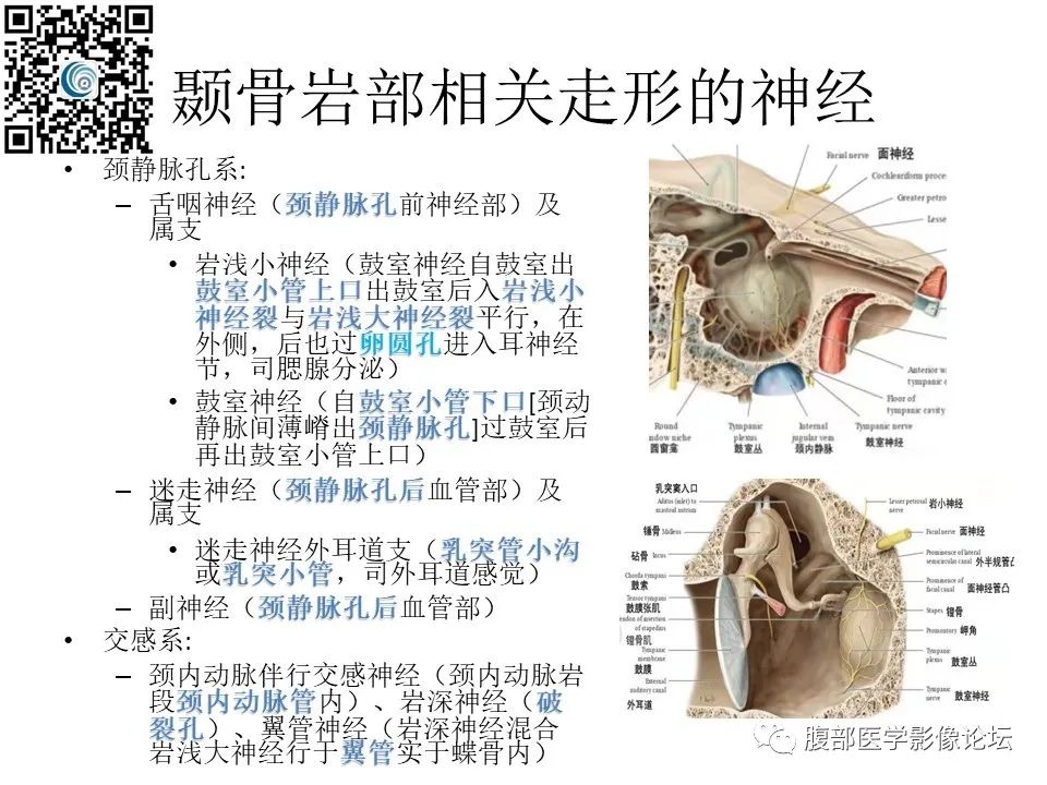影像PPT - 【PPT】颅骨颅底系列之岩洞深处住神仙-19