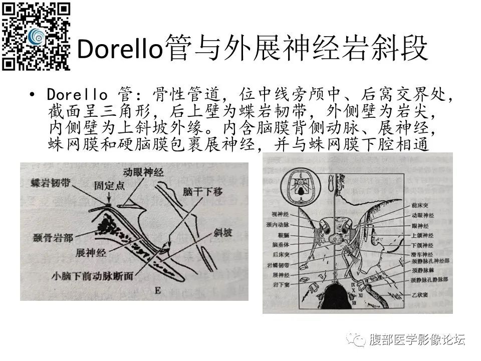 影像PPT - 【PPT】颅骨颅底系列之岩洞深处住神仙-27