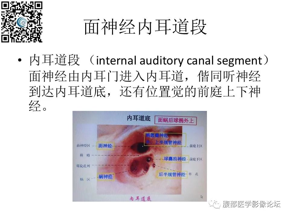 影像PPT - 【PPT】颅骨颅底系列之岩洞深处住神仙-29