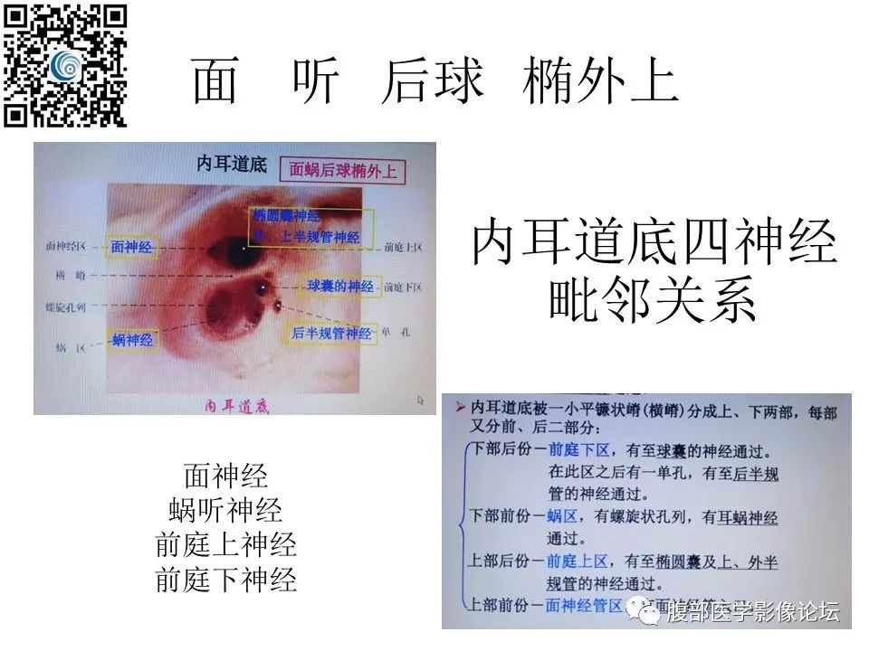 影像PPT - 【PPT】颅骨颅底系列之岩洞深处住神仙-32