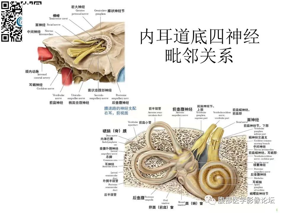 影像PPT - 【PPT】颅骨颅底系列之岩洞深处住神仙-33
