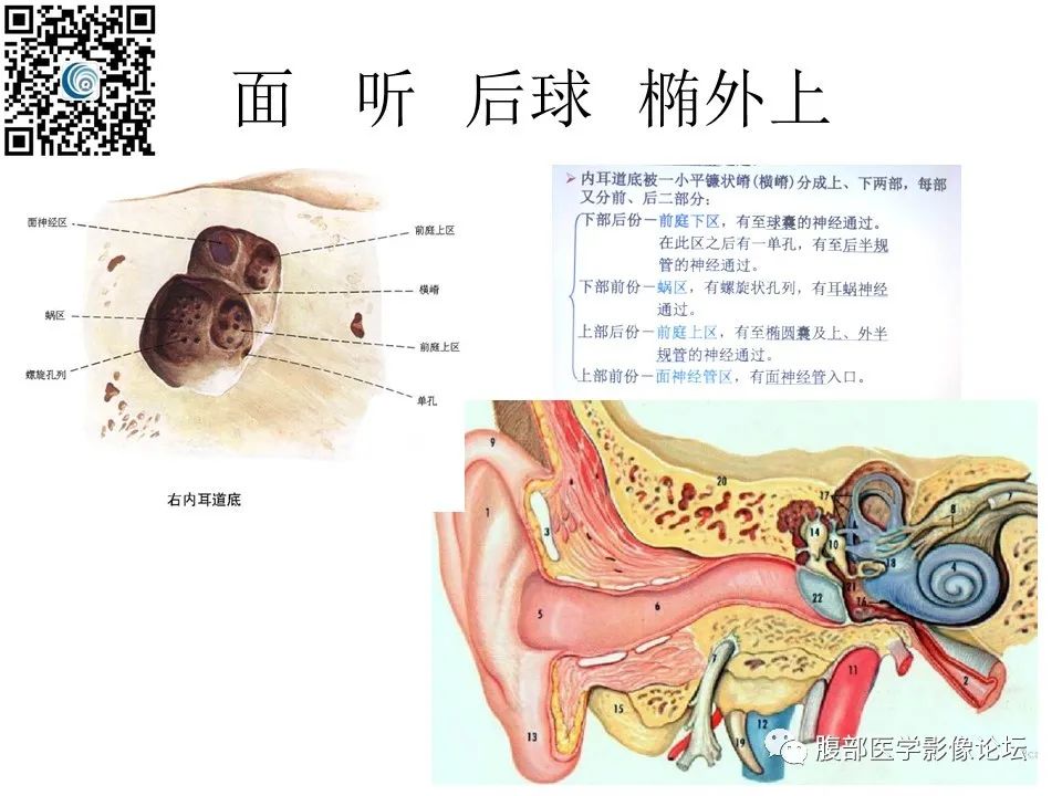 影像PPT - 【PPT】颅骨颅底系列之岩洞深处住神仙-34