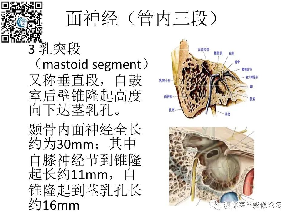 影像PPT - 【PPT】颅骨颅底系列之岩洞深处住神仙-43