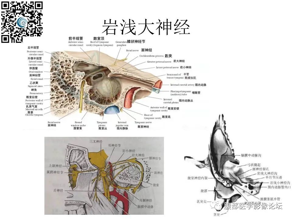 影像PPT - 【PPT】颅骨颅底系列之岩洞深处住神仙-70