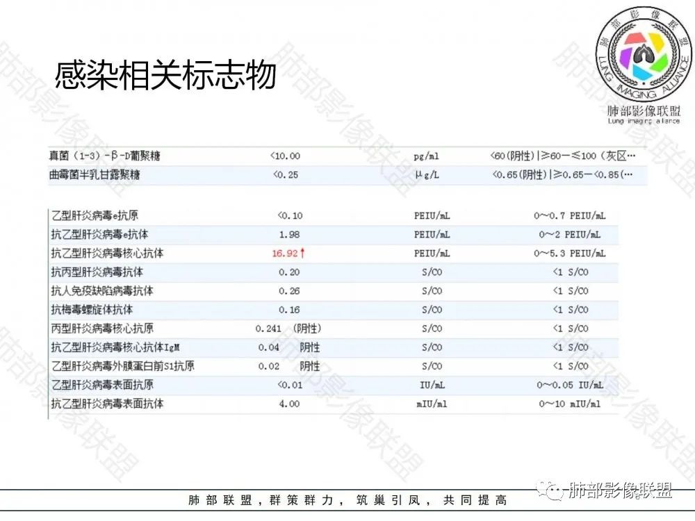 影像PPT - 【病例】鉴别肺脓肿与肺鳞癌——寻蛛丝马迹-7 影像PPT - 【病例】鉴别肺脓肿与肺鳞癌——寻蛛丝马迹-7