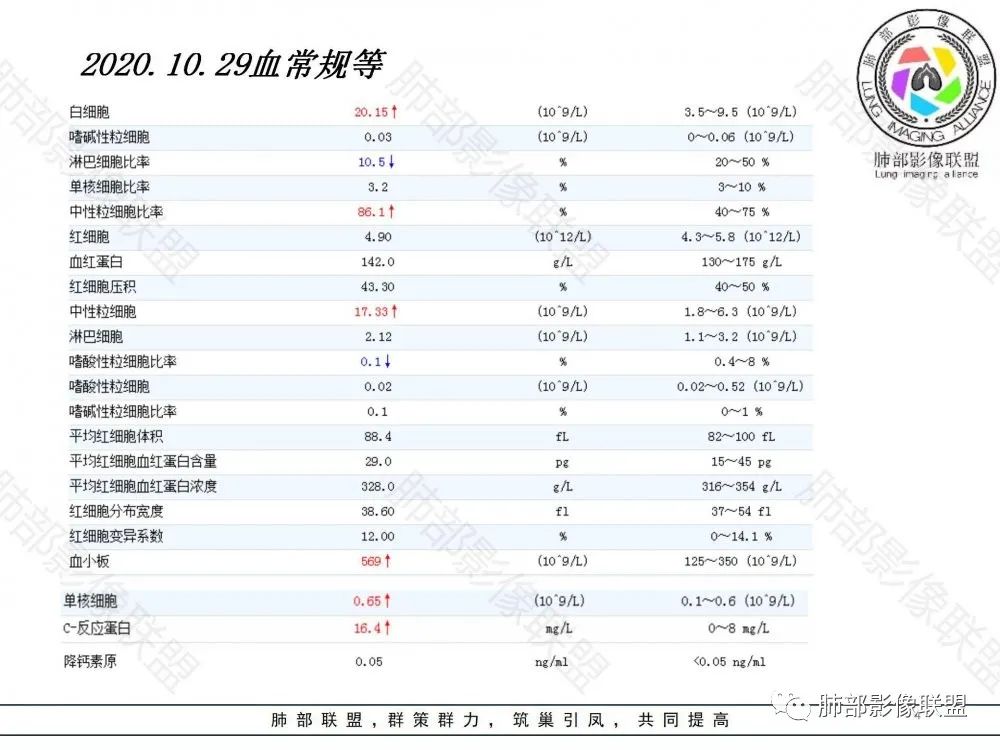 影像PPT - 【病例】鉴别肺脓肿与肺鳞癌——寻蛛丝马迹-4 影像PPT - 【病例】鉴别肺脓肿与肺鳞癌——寻蛛丝马迹-4