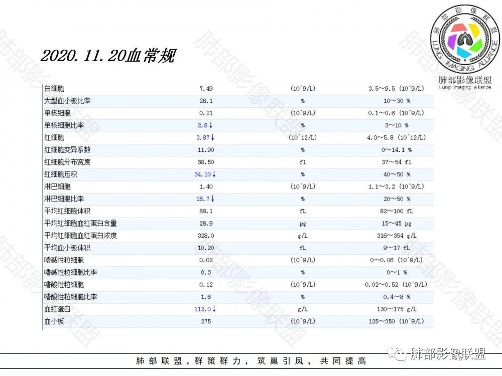 影像PPT - 【病例】鉴别肺脓肿与肺鳞癌——寻蛛丝马迹-5 影像PPT - 【病例】鉴别肺脓肿与肺鳞癌——寻蛛丝马迹-5
