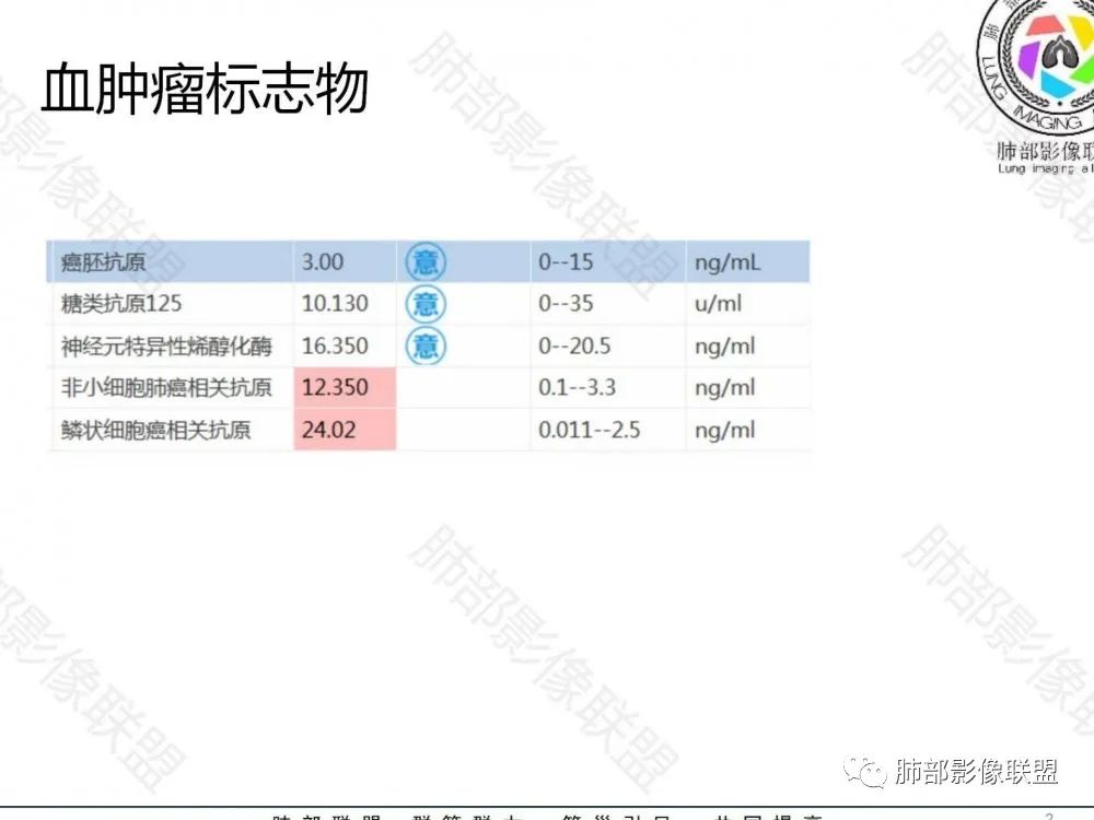 影像PPT - 【病例】鉴别肺脓肿与肺鳞癌——寻蛛丝马迹-31 影像PPT - 【病例】鉴别肺脓肿与肺鳞癌——寻蛛丝马迹-31