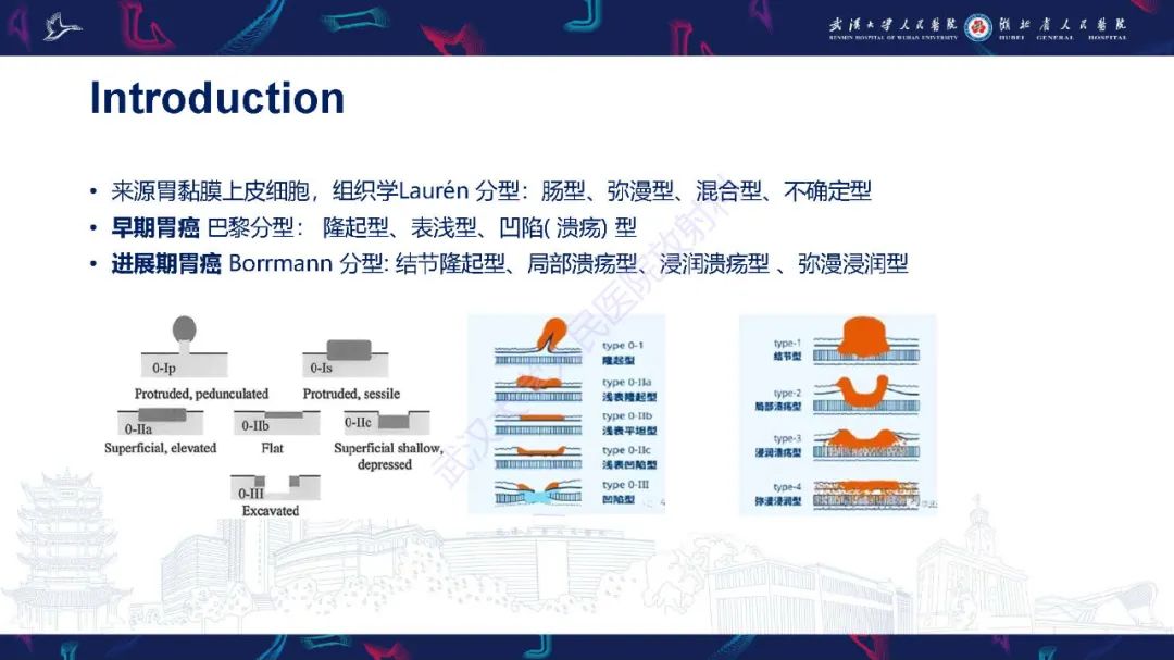 影像PPT - 【PPT】胃癌淋巴引流及TNM分期-3