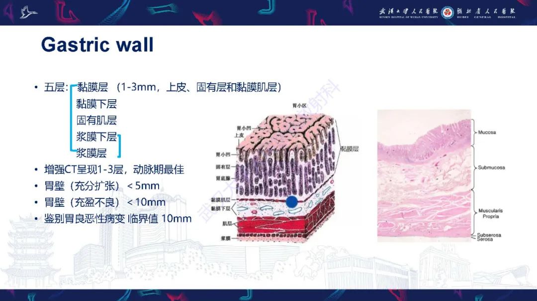 影像PPT - 【PPT】胃癌淋巴引流及TNM分期-7