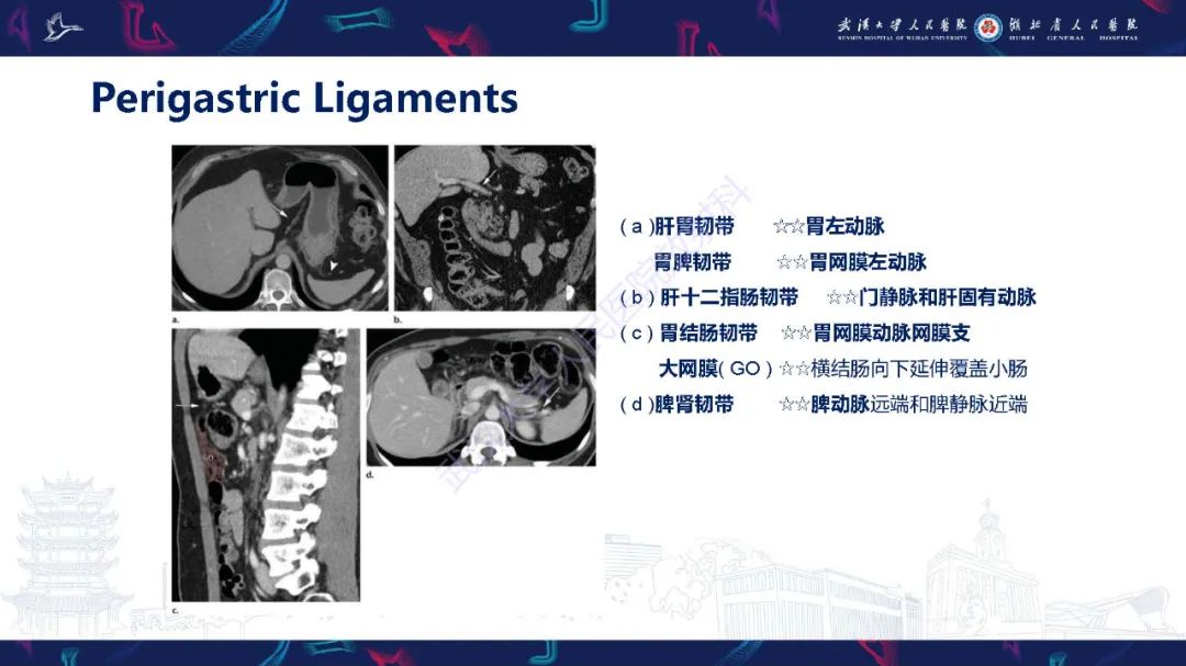 影像PPT - 【PPT】胃癌淋巴引流及TNM分期-12