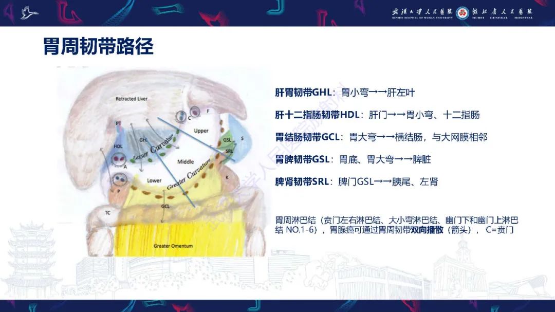 影像PPT - 【PPT】胃癌淋巴引流及TNM分期-11