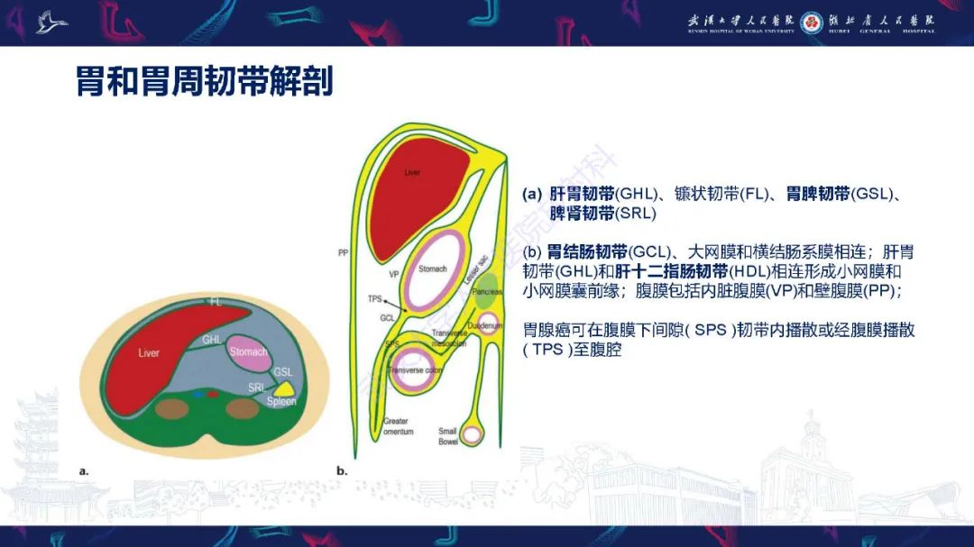 影像PPT - 【PPT】胃癌淋巴引流及TNM分期-10