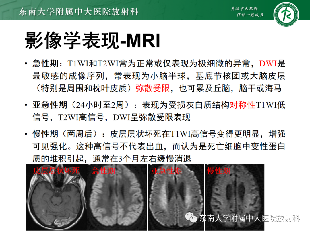 影像PPT - 【PPT】成人缺血缺氧性脑病(HIE)-12 影像PPT - 【PPT】成人缺血缺氧性脑病(HIE)-12